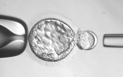 Timing of biopsy biopsy Advantages of blastocyst Smaller proportion of only extra-embryonic cells are removed No impact on developmental and