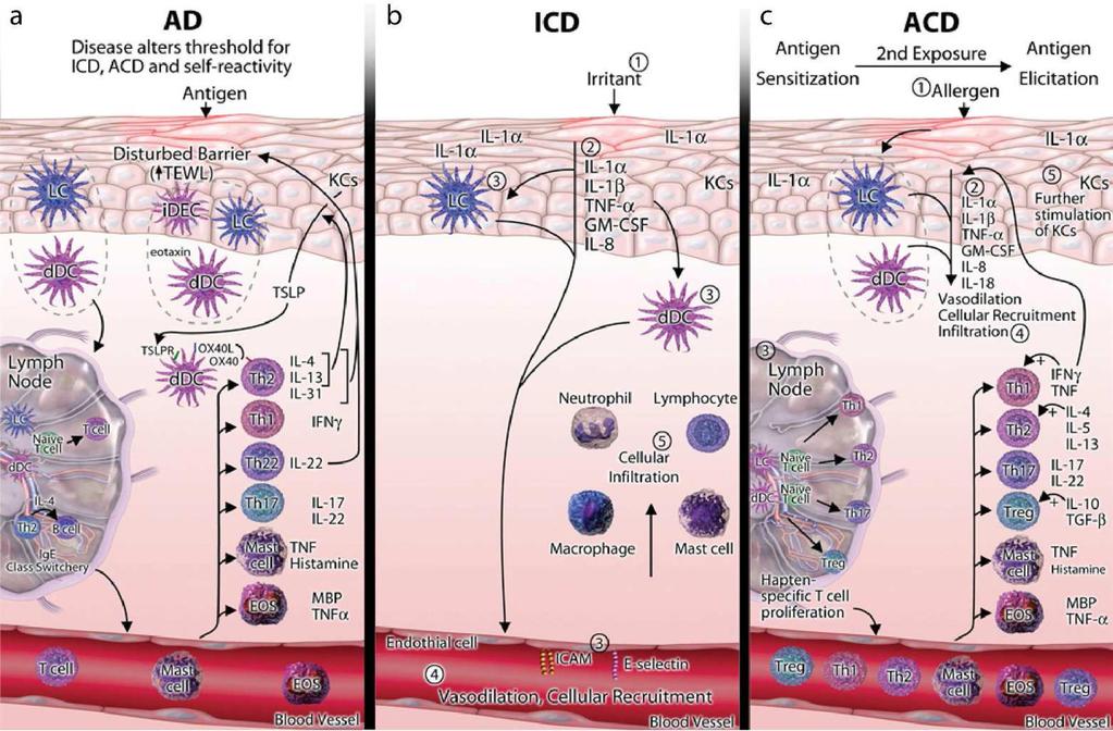 Dhingra et al. Page 6 NIH-PA Author Manuscript NIH-PA Author Manuscript Figure 1. NIH-PA Author Manuscript Immune mechanism in the pathogenesis of ICD, ACD, and AD.