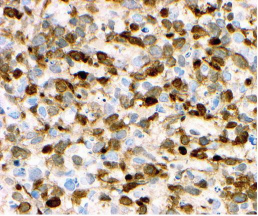 and immunohistochemical stains of