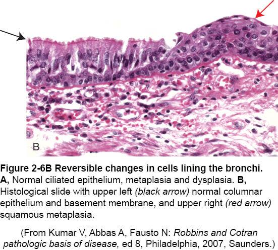 The newly formed squamous epithelial cells do not secrete mucus or have