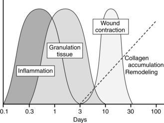 2 most important questions in Wound Care To the patient: How long as it been there? To yourself: why do they have a wound?