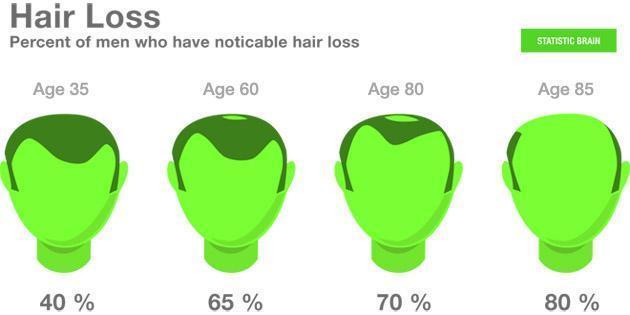 And according to health.com, there are 21 reasons for losing your hair. It doesn t mean you have hair loss problem if you lose 50 to 100 hairs a day. This is normal.
