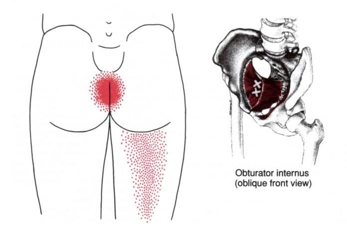 Vaginal Trigger Point Injections May need to be done in the operating room with IV sedation Some patients tolerate this in clinic Patients need to be responsive enough to direct