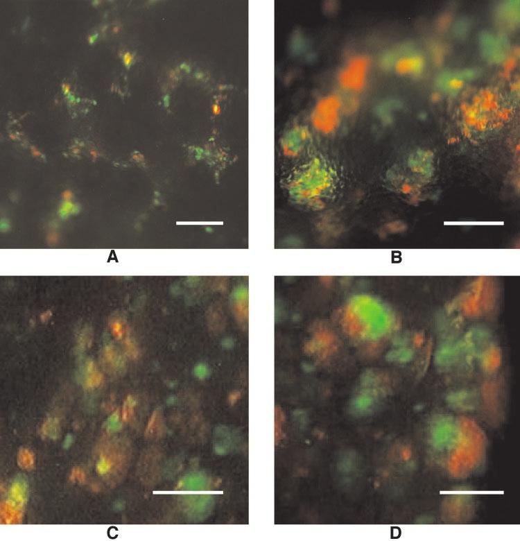 the mice were sacrificed, and lung metastases were evaluated under fluorescence microscopy. Subsequently, 1 10 5 cells were found to be the minimum cell number to produce metastases.