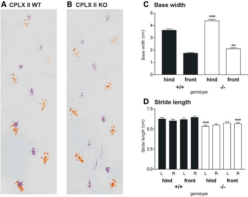 Human Molecular Genetics, 2003, Vol. 12, No. 19 2435 Figure 3. Gait differences between WT and CPLXII KO mice.