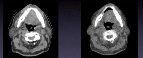Patient Image: Head and Neck