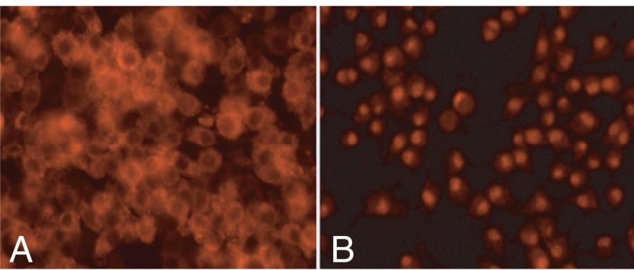 5. Data Analysis Performance Characteristics - Cell Staining Figure 1. Translocation of SREBP-2 into nuclei by U-18666A. Raw 264.