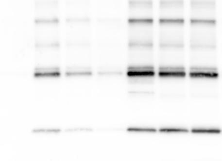 RESEARCH SUPPLEMENTARY INFORMATION c d CPPD Nigericin dsdna Flgellin CCl 2 CCl 2 CCl 2 CCl 2 CCl 2 GdCl 3 MgCl 2 Pro- e CCl 2 (1 mm) (mm) f (2 mm) CCl 2 (mm).7 1.3 2.