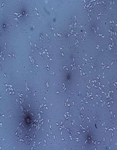 Sources of cryopreserved germplasm: Male gametes (water buffalo, cattle and goats) 1. PCC water buffalo semen production centers a.