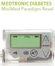 Hybrid closed loop personal pump with CGM Automatically adjusts basal insulin