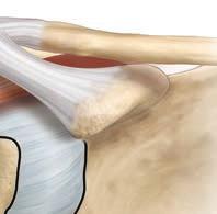 Normal Shoulder The humeral head is the ball at