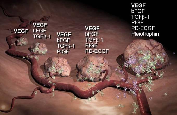 VEGF Is the Only Angiogenic Factor Present Throughout the Tumor Life Cycle VEGF, vascular endothelial growth factor Bergers G, et al.