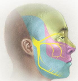 Trigeminal Neuralgia Compression, degeneration or inflammation of the 5 th cranial nerve may result in a condition called trigeminal neuralgia or tic douloureux (spasmodic contraction of the muscles