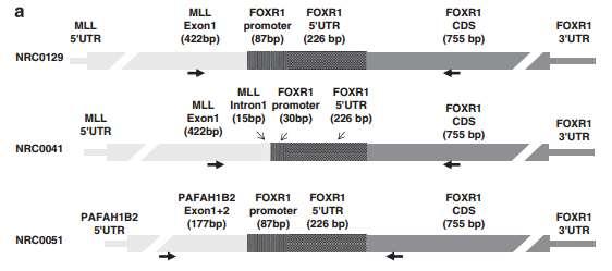 FOXR1 only expressed in combination with Structural Variation Neuroblastoma Ped.