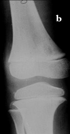 37a:  in tibia. Fig.