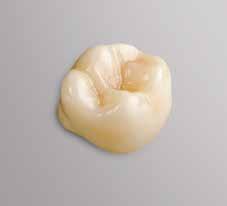 variety of materials Excellent milling and grinding results Direct clinic-to-laboratory commissioning Implantology Chairside implantology with custom abutments or screwretained crowns