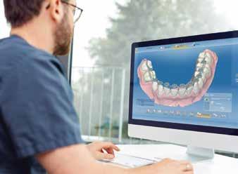 Data transfer to laboratories or external service providers for a wide range of appliances such as clear aligners, bonding trays,