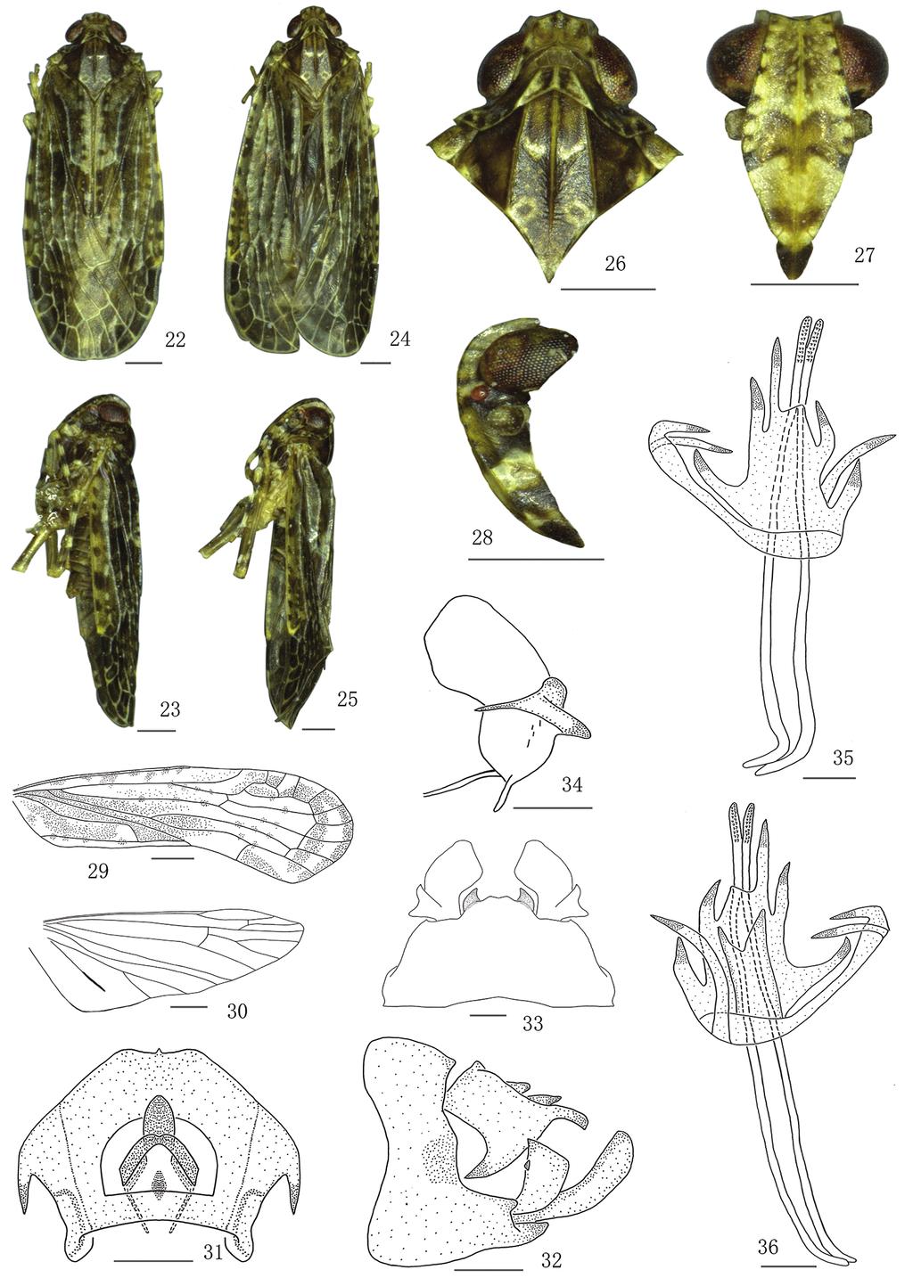 88 Shi-Yan Xu et al. / ZooKeys 787: 81 90 (2018) Figures 22 36. Magadhaideus pingbianensis sp. n.