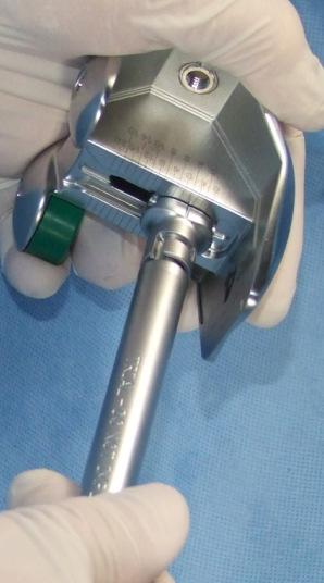 5mm (GOLD) Hex Driver Shaft and one of the blue Silicone Square Drive Handles as determined by one of the two following methods: Method 1 - Trial Femur Assembly With the appropriate valgus bushing