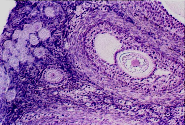 TERTIARY EARLY ANTRAL FOLLICLES DIFFUSED