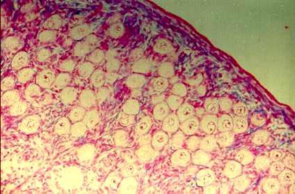 OVARY The surface of the ovary is covered with surface epithelium, a simple epithelium which changes from squamous to cuboidal with age.