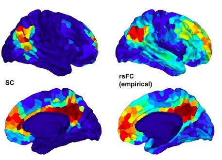 DTI Network Rs-fcMRI