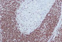 Immunohistochemistry Primary Antibodies Genemed offers primary antibodies with high affinity and specificity for in vitro diagnostic and research use.