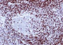 Tissue Mesothelioma CD3 61-0011, 61-0011-5, 61-0011-2 /