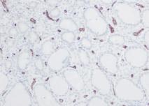 Positive Control Tissue Small cell lung