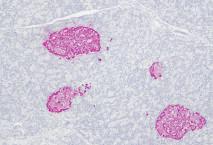 IgG2a Cytoplasm and Membrane Positive Control Tissue Colon