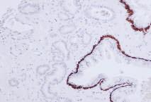 IgG2a Cytoplasm Positive Control Tissue Colon