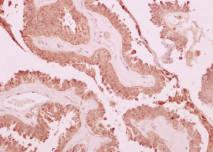 Control Tissue Astrocytomas HER2 GR011 61-0154, 61-0154-5,