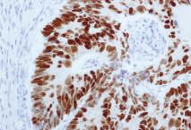 2 ml / RTU 7 ml Positive Control Tissue Cytoplasm Paraganglioma Non-Immune