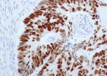 2 ml / RTU 7 ml Positive Control Tissue Nucleus Selective Squamous Cell Carcinoma p63