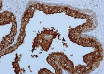Cytoplasm Positive Control Tissue Prostate PsAP