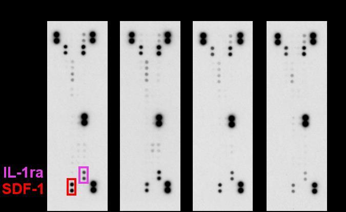 ppendix Figure S8 C ppendix Figure S8. (-) Cytokine array analysis using a standard kit in blood serum of KPC allografts obtained 5 days after treatment as indicated.