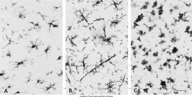 Microglia: phagocytotic cells - main elements of the intrinsic immune system - sense