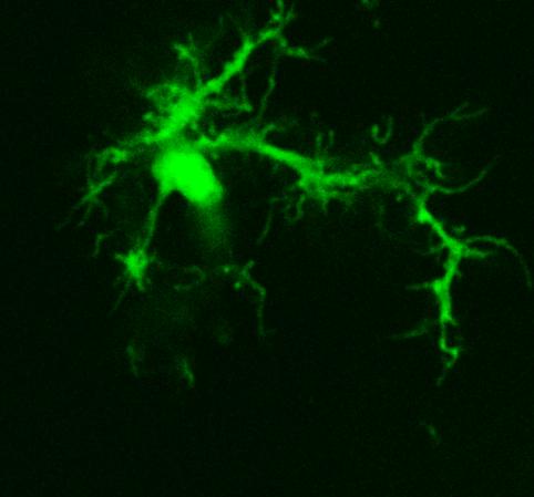Microglial cell expressing GFP