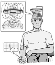 Therapeutic Brain Stimulation A New Avenue for Clinical Translation of Neuroimaging Research?