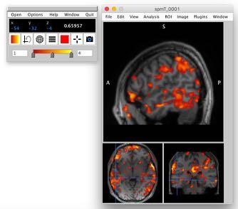 Check out MRI and fmri data yourself!