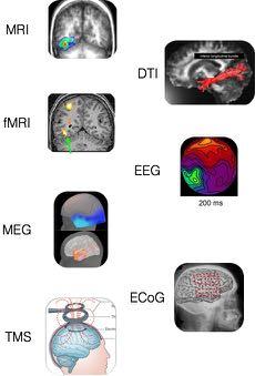 Cheat-sheet» Structural MRI images different tissue types in 3D with high resolution. The DTI variant measures white-matter connectivity.
