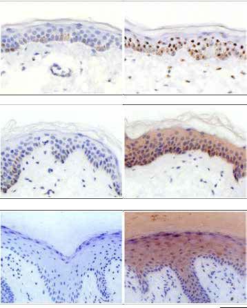 NLRP1 is the predominant NLR in human skin 80 60 **** NLRP1 NLRP3 RNAscope: dapb RNAscope: NLRP1 FKPM 40 20 0 AIM2 NLRC4 MEFV hair-bearing skin IHC: no primary Ab IHC: NLRP1 Skin Bone marrow Spleen