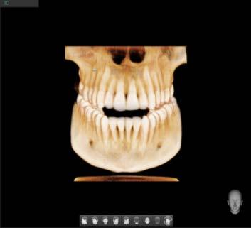 Achieve the goals set for investing in a 3D X-ray machine Proper FOV for Better Treatment Planning The CBCT FOV determines how much of the patient's anatomy you will be able to visualize.