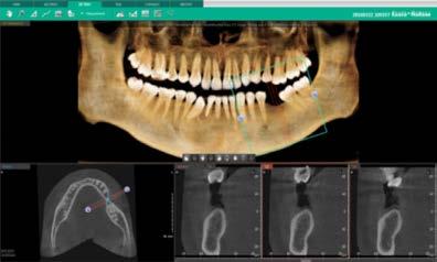 are barriers to using CBCT