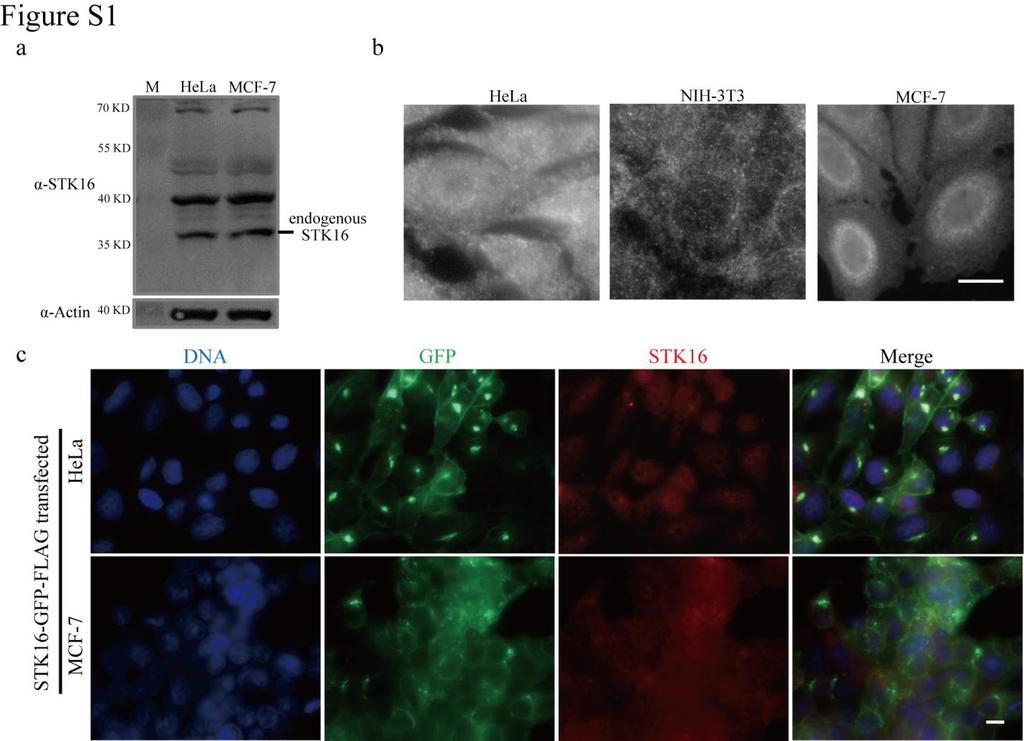 Supplemental Materials STK16 regulates actin dynamics to control Golgi organization and cell cycle Juanjuan Liu 1,2,3, Xingxing Yang 1,3, Binhua Li 1, Junjun Wang 1,2, Wenchao Wang 1, Jing Liu 1,