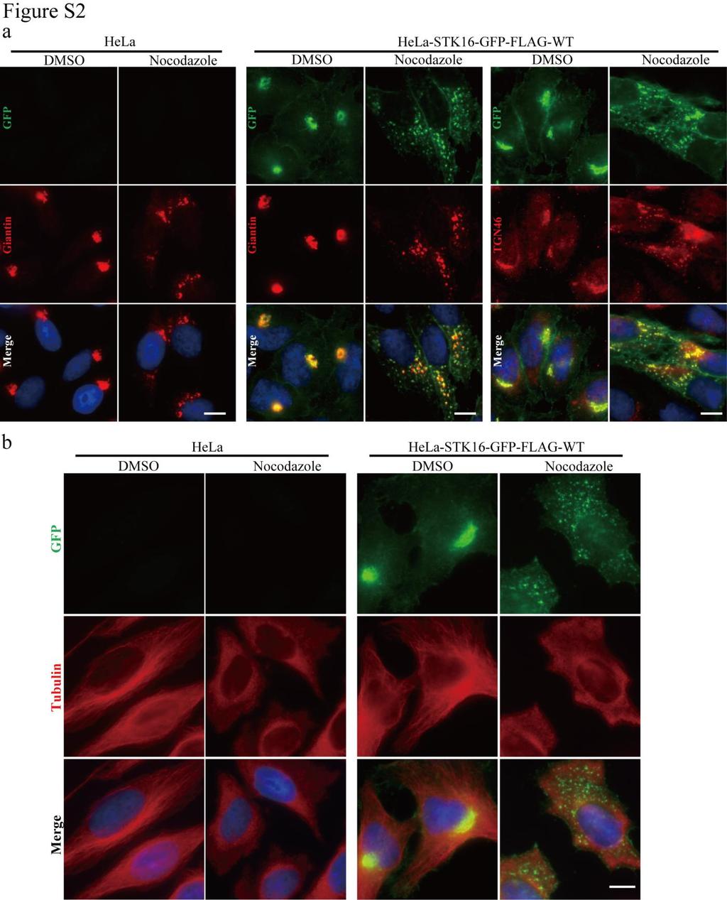 Figure S2. STK16 colocalizes with Golgi and TGN markers in Nocodazole-treated cells.