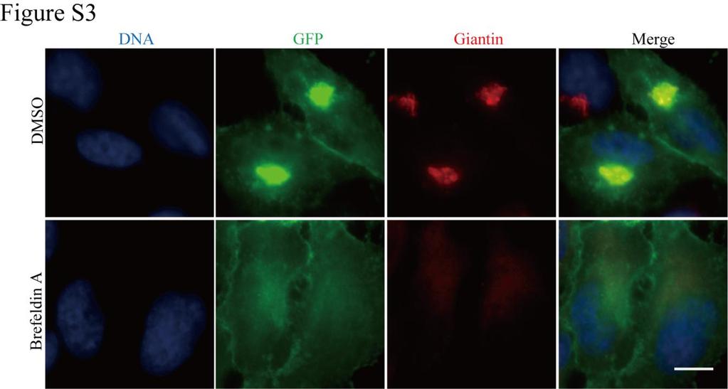 Figure S3. The Golgi localization of STK16 was dispersed by Brefeldin A treatment.