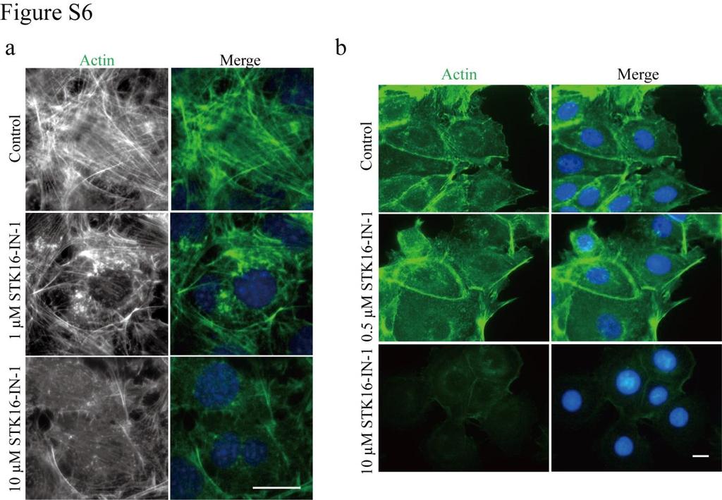 Figure S6. Actin cytoskeleton is decreased significantly by STK16-IN-1 in both NIH-3T3 and MCF-7 cells.