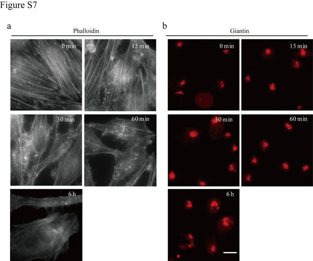 Figure S7. STK16-IN-1 disrupts actin stress fiber earlier than Golgi complex.