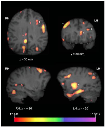 Language area homologs in chimpanzee cortex? Taglialela et al. 2008 used PET (positron emission tomography) to study communicative signaling (gestures and calls) in captive chimpanzees.